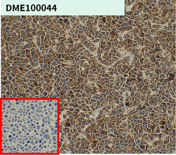 dme100044-cd138-ihc1.jpg