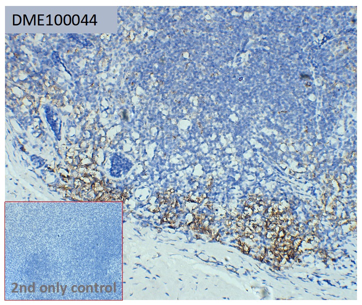 dme100044-cd138-ihc2.jpg