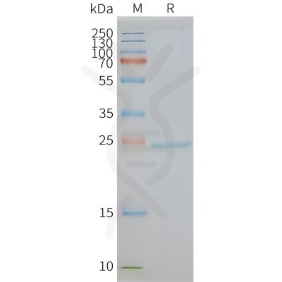 page-FLP100050 CD81 Fig.2 SDS PAGE 1