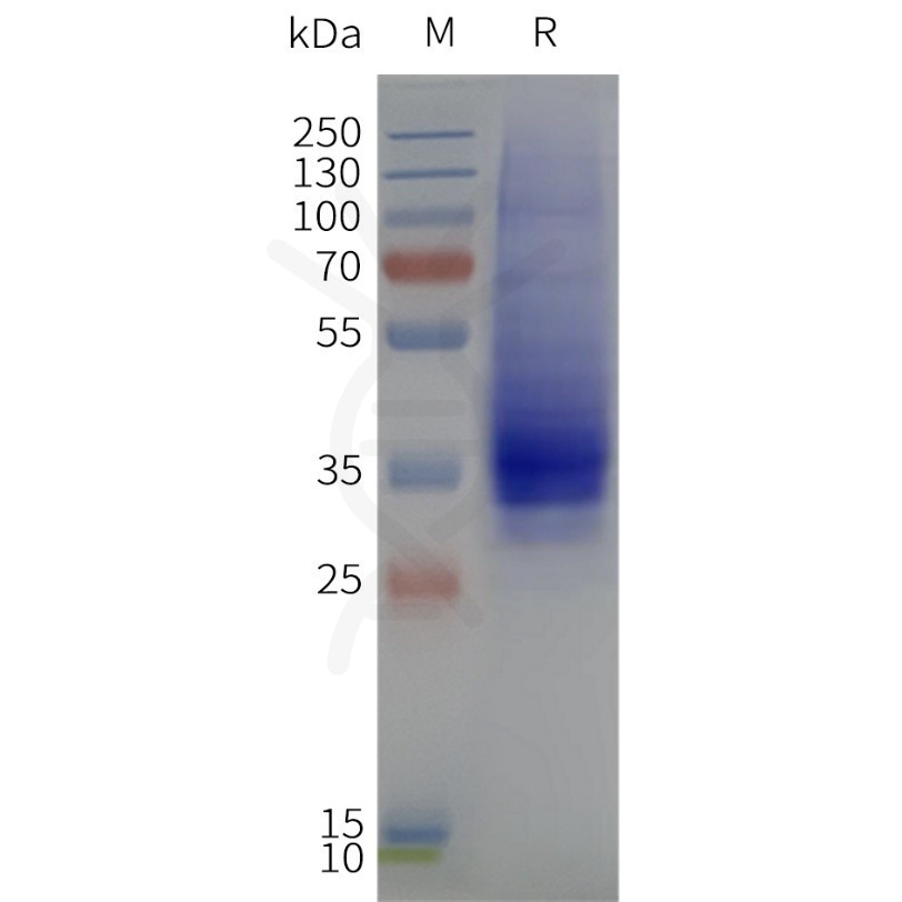 page-flp120306 gpr35 strep sp1 1