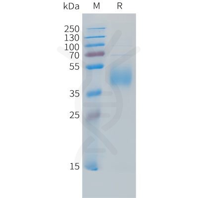 sp-PME C100031 B7 H6 Fig.1 SDS PAGE 1