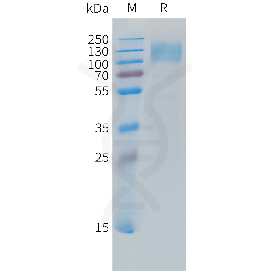 sp-PME C100033 CEACAM5 Fig.1 SDS PAGE 1