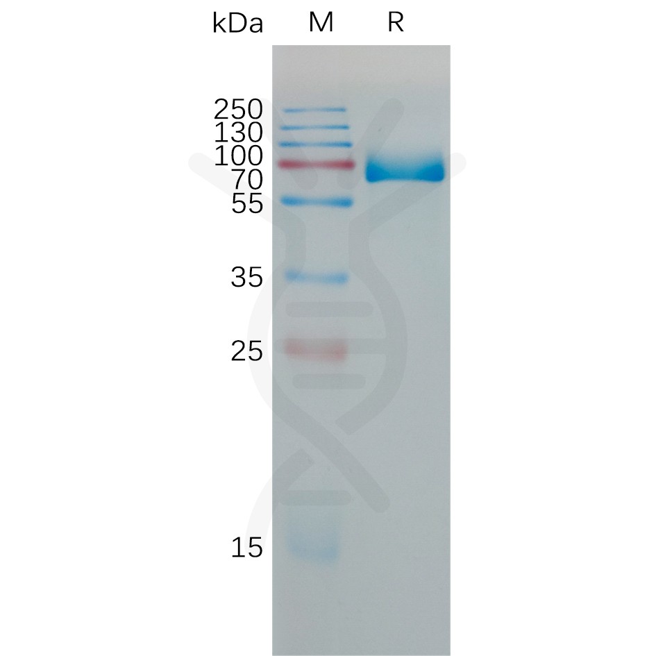 sp-PME M100077 PD L1 Fig.1 SDS PAGE 1