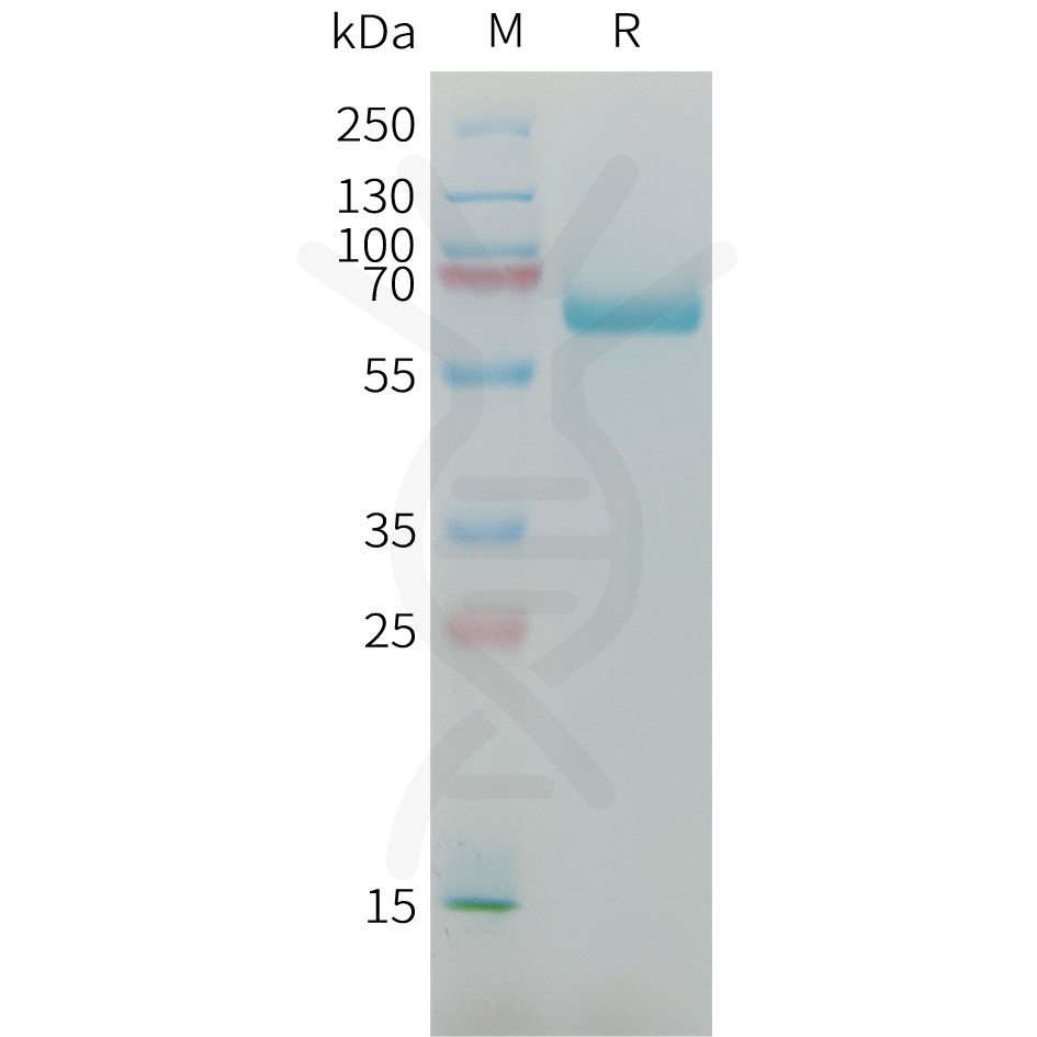 sp-PME M100092 AFP Fig.1 SDS PAGE 1