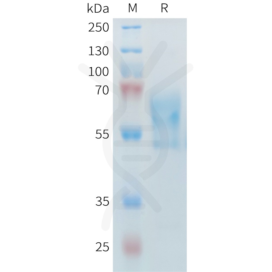 sp-PME M100099 PD 1 Fig.1 SDS PAGE 1