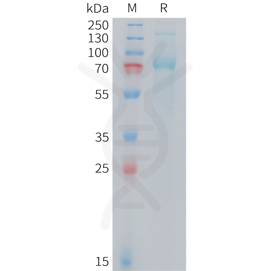 sp-PME M100104 TFRC Fig.1 SDS PAGE 1