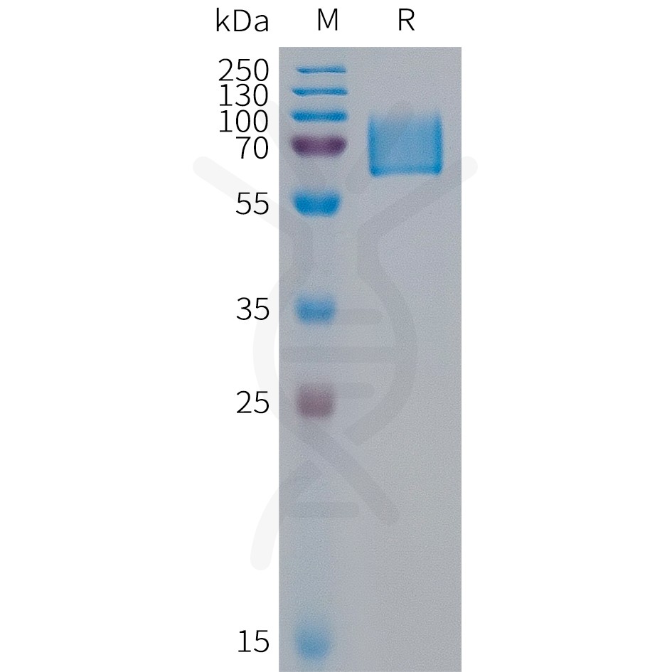 sp-PME100317 KIR2DL1 Fig.1 SDS PAGE 1