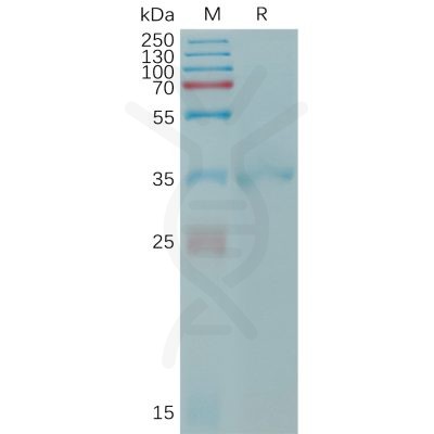 sp-PME101206 CLDN6 Fig.1 SDS PAGE 1