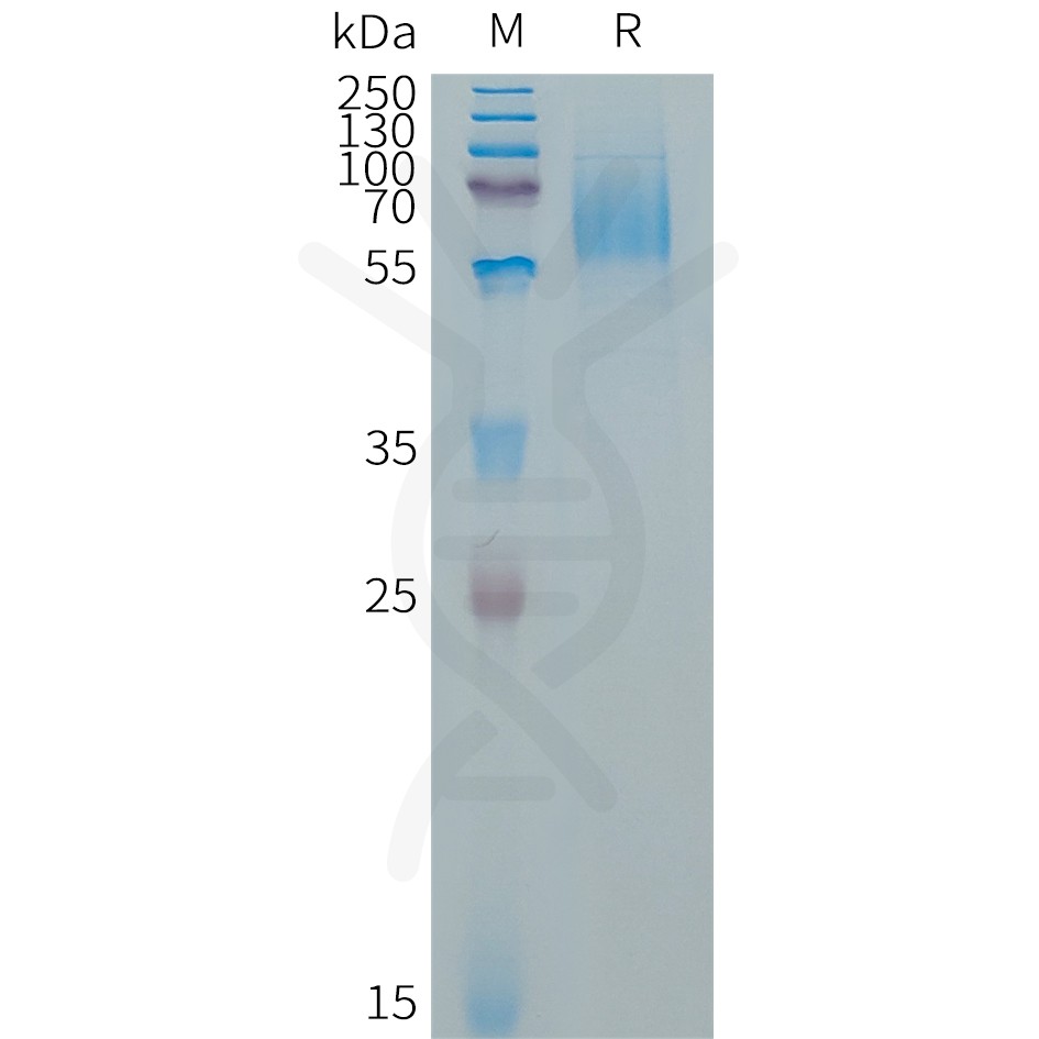 sp-PME101321 EGFRVIII Fig.1 SDS PAGE 1