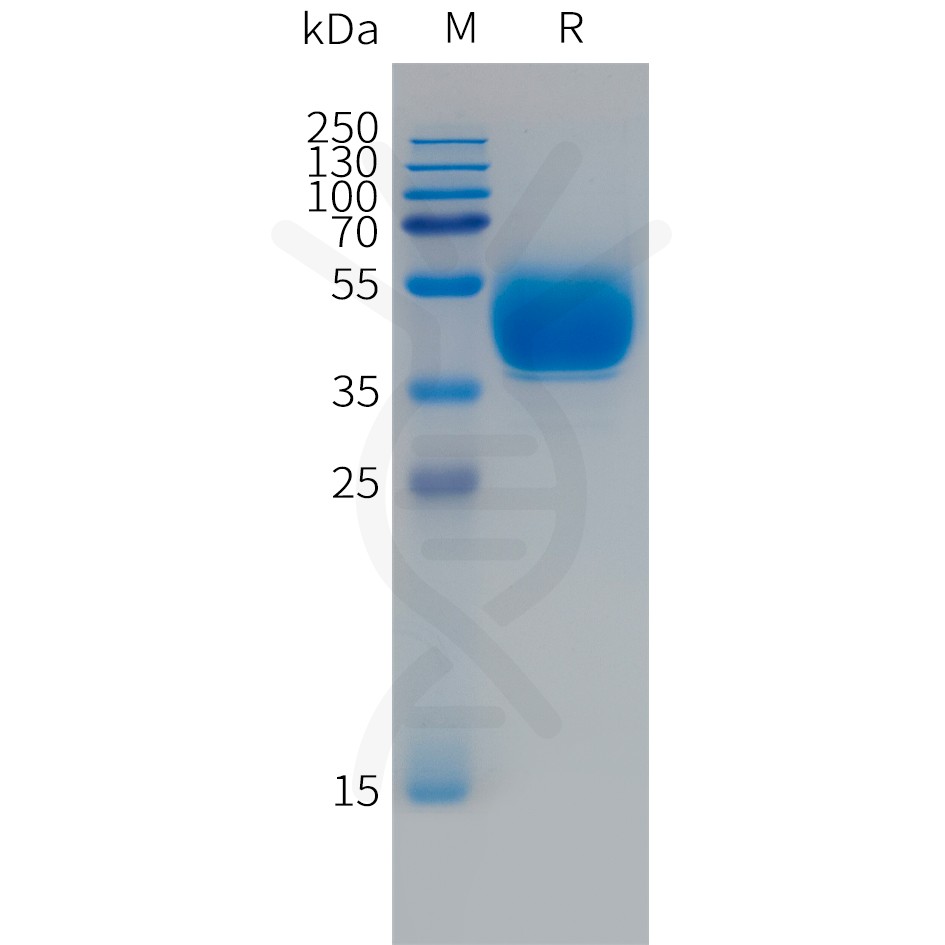 sp-PME101494 FCRL5 Fig.1 SDS PAGE 1