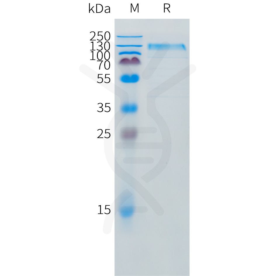 sp-pme d100010 il31ra sp1