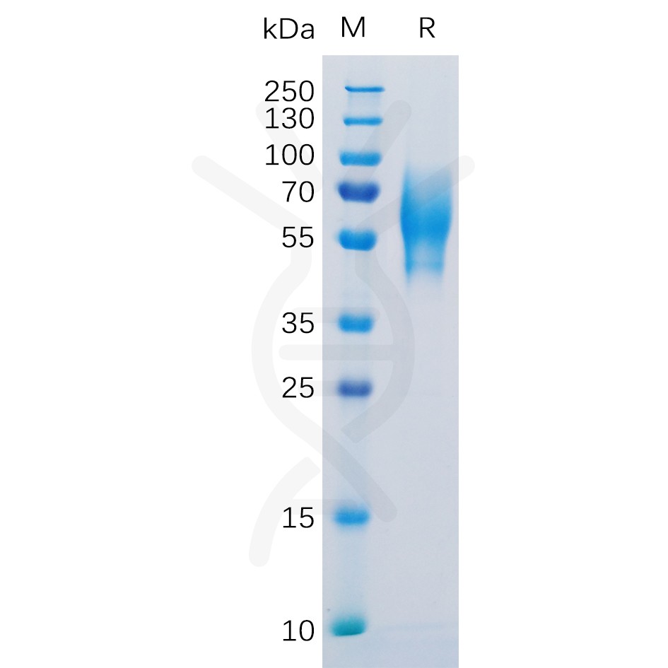 sp-pme100123 5t4 sp1