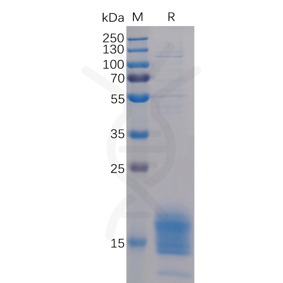 sp-pme100506 tigit sp1