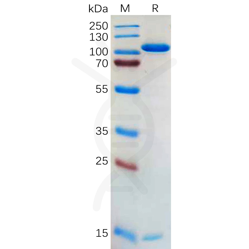 sp-pme100562 pcsk9 sp1