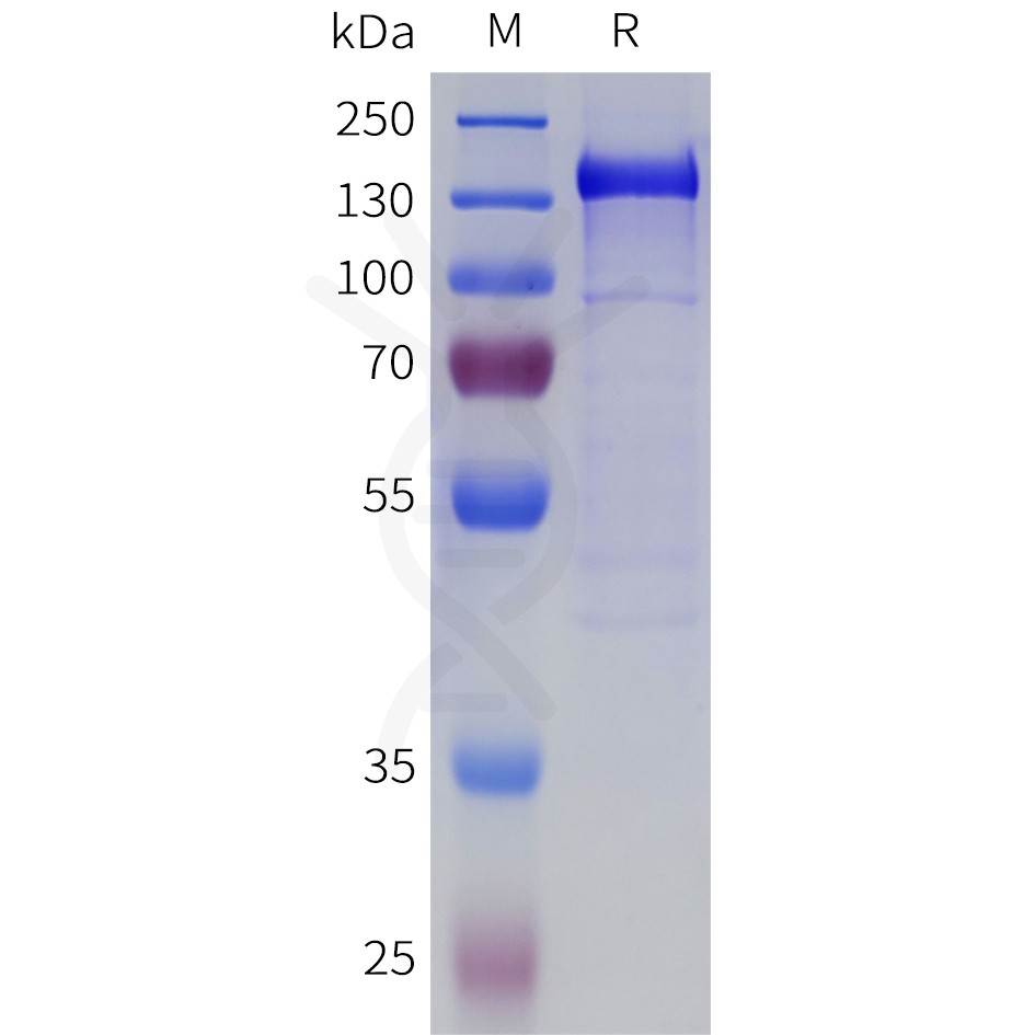 sp-pme100913 bai1 sp1