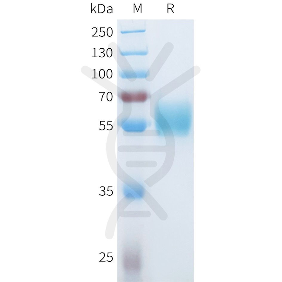 sp-pme101581 ror1 sp1